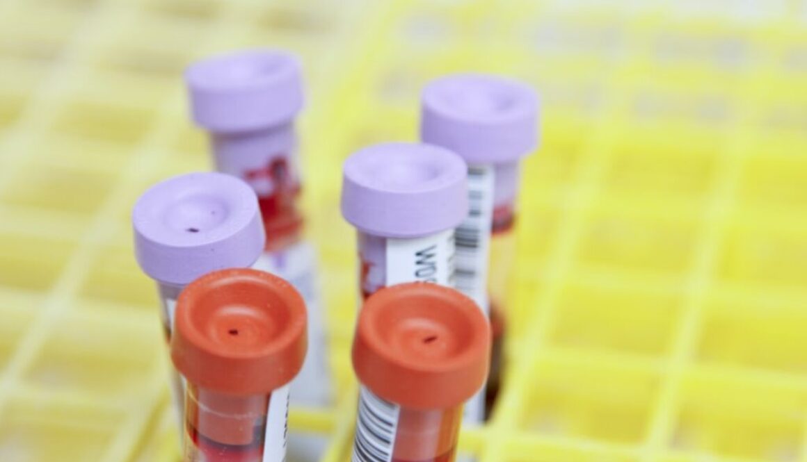 Reakcje redox – poznaj kluczowe zasady chemii nieorganicznej